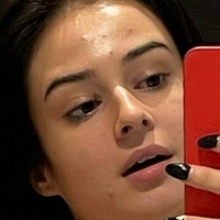 Lauraysergii Desnuda